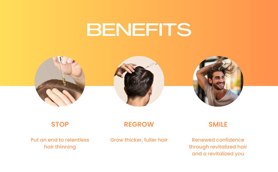 Minoxidil Topical Solution USP 5%, Extra Strength Hair Regrowth Treatment for Men, 1 Month Supply, Unscented, 2 Fl Oz (1 Pack)