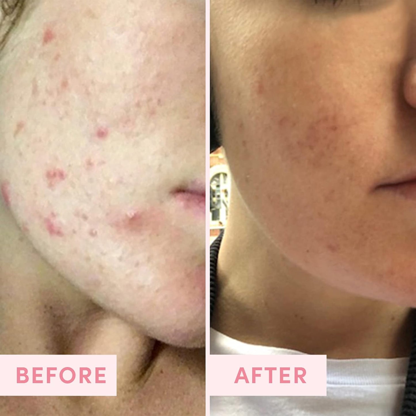 Sand & Sky Australian Pink Clay Detoxifying Face Mask with Vitamin C & Antioxidants - Pore Clearing Clay Mask for Blemish-Prone Skin, Fades Hyperpigmentation & Evens Tone