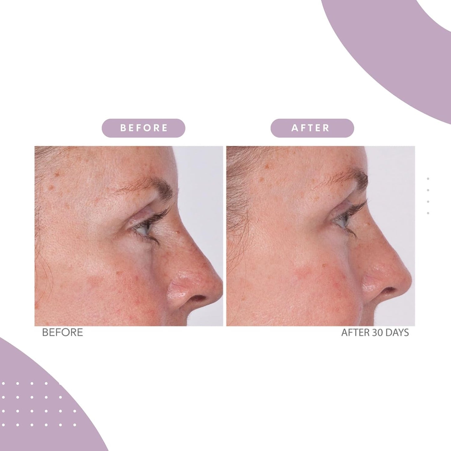 Serious Skincare - Reverse Lift Eye Cream Moisturizer with Peptides, Bladderwrack Seaweed - Skin Firming and Lifting Wrinkle Formula - Women, Men - Temporarily Lift & Firm Eye Area - 1 oz.