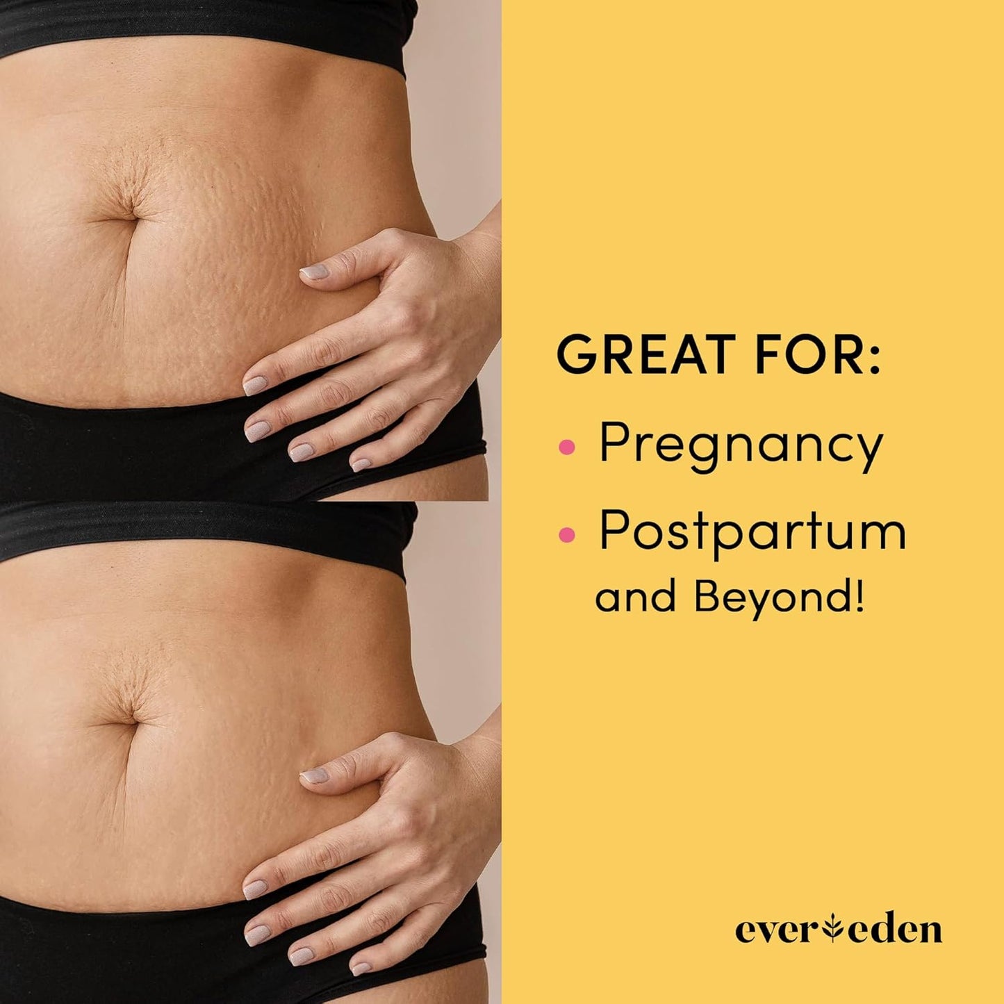 Evereden Mama Must-Have DUO - Golden Belly Stretch Mark Oil 30ml & Nourishing Stretch Mark Cream 50ml - Derma-Developed Clean & Vegan Maternity Skin Care for Stretch Mark Reduction & Skin Hydration