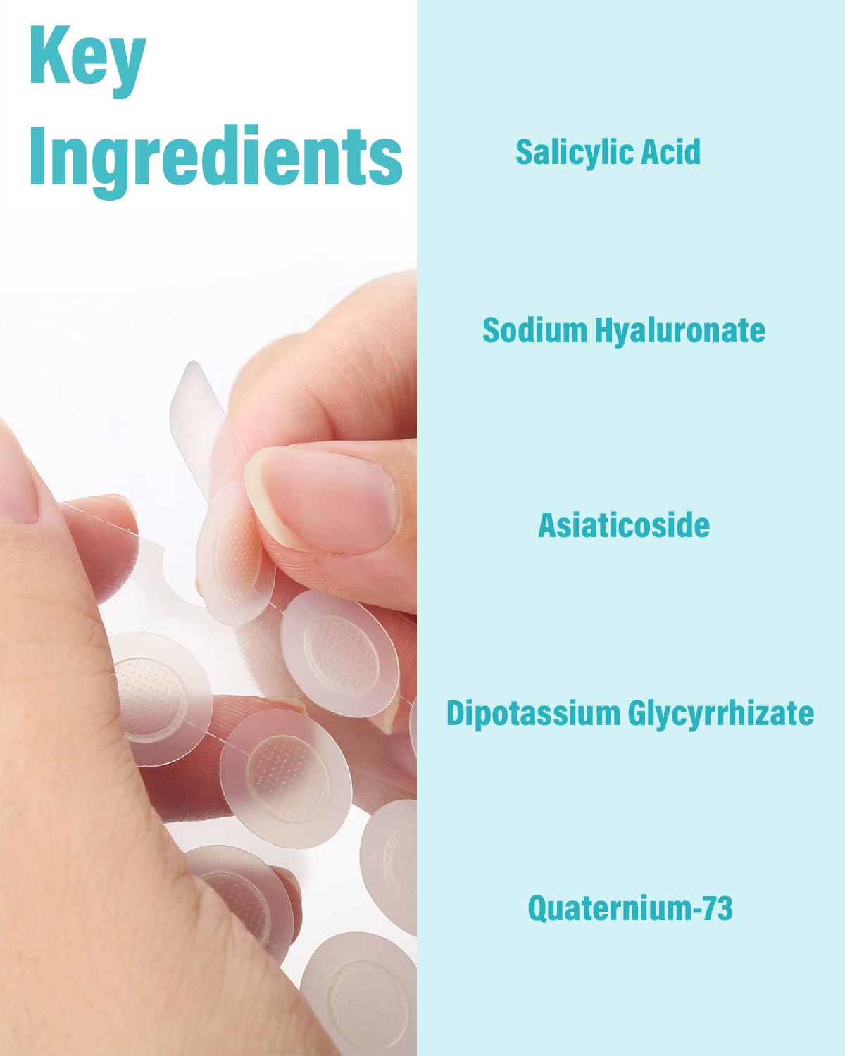 Microdart Acne Patch (36 Patches) - Hyaluronate Acid & Salicylic Acid Hydrocolloid Pimple Patch for Deep, Early and Hidden Blemishes (36 Count (Pack of 1))