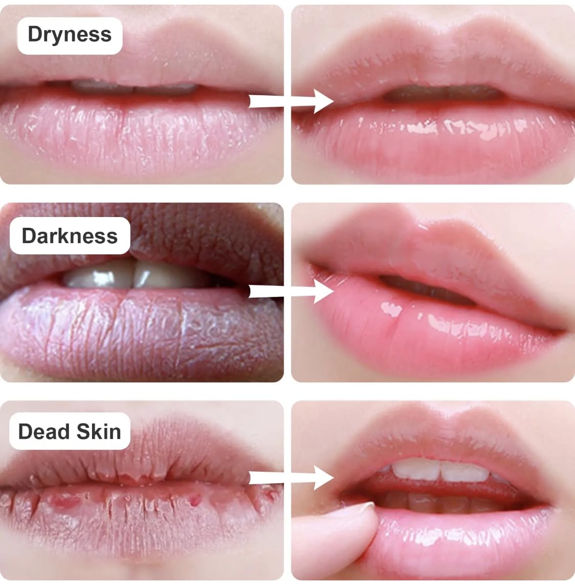 New Lip and Eye Mask 2 Sets, Hydro-Gel Eye Mask For Puffiness, Lip Collagen Plumper, Eye Mask Skincare, Rich Goat Milk (white/white)