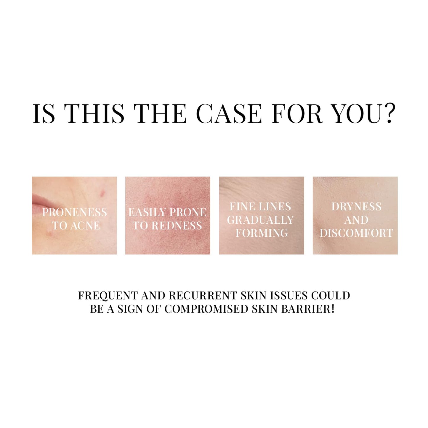 +WIS+ Hyaluronic Acid Sheet Mask 5 EA with Hyaluronic Acid Serum and Vitamin B5, Hydrating Facial Mask for Dry Skin, Anti-Aging Mask to Plump and Repair Dehydrated Skin, Safe on Sensitive Skin