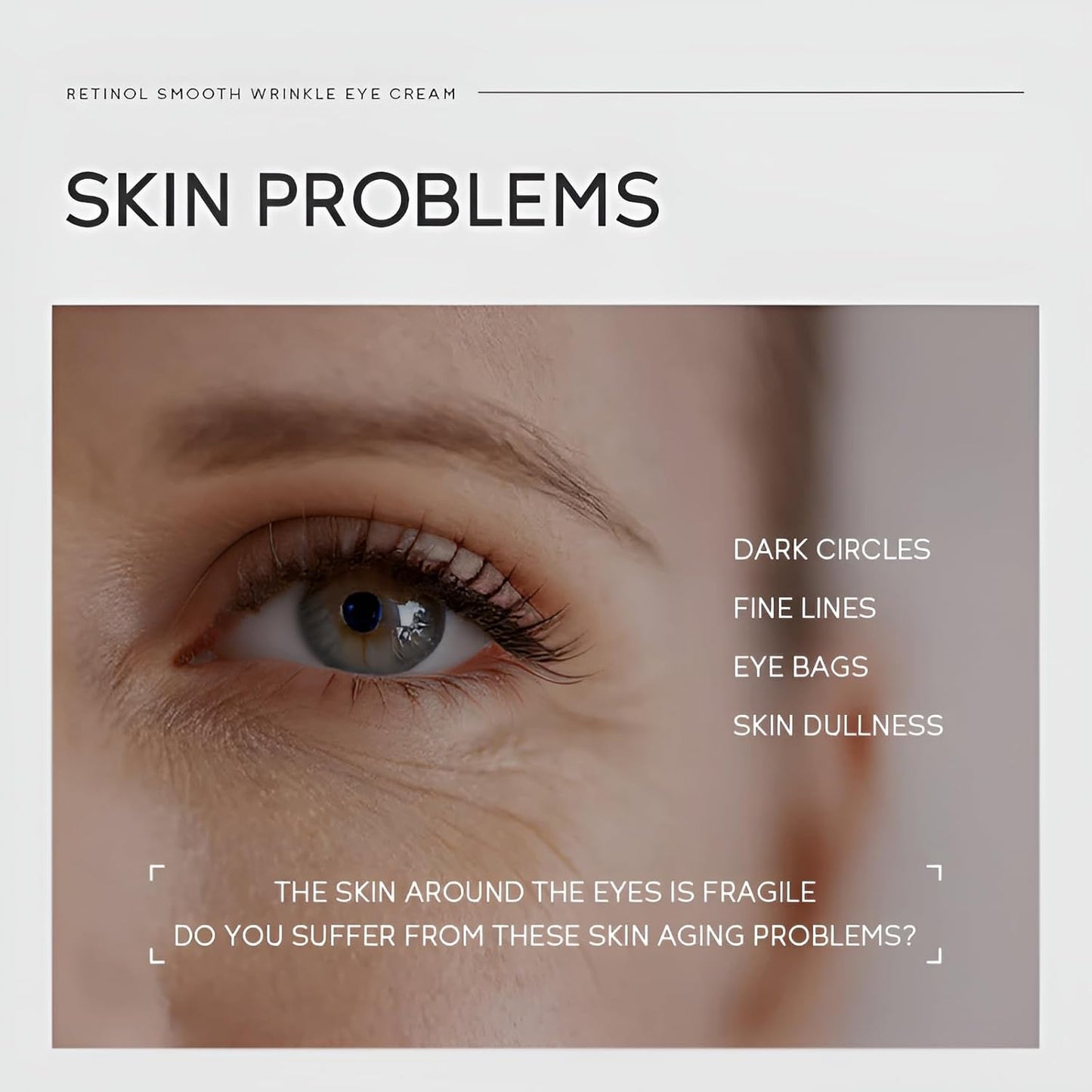 Retinol Eye Cream for Dark Circles Puffiness and Eye Bags, Anti Aging Under Eye Cream Treatment for Women Men, Fine Lines & Wrinkles Repair, Instant Results Firm Eye Tightener, 0.53oz, 2 Pack