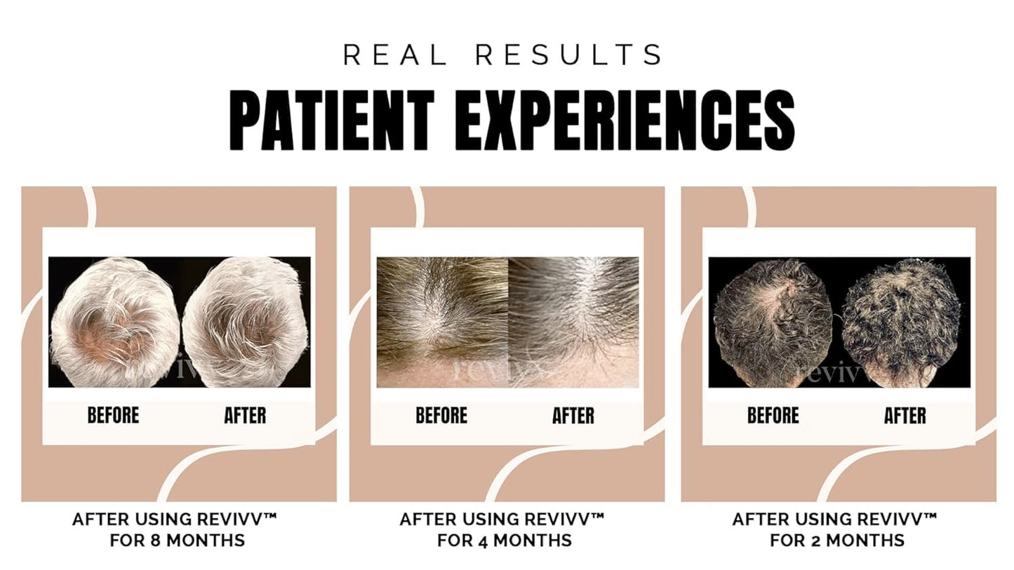 REVIVV Hair Growth Serum for Men, Starter 1-Pack, 100% Natural Topical Solution for Visibly Thicker, Fuller Hair Regrowth, Dermatologist Recommended, One 1oz Bottle, 45-Day Supply