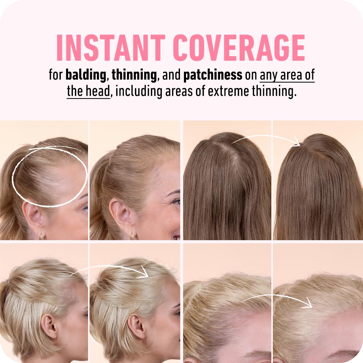 BOLDIFY Hairline Powder (LARGE, 10g) - Root Touch Up Hair Color for Gray Coverage - Bald Spot Concealing Hair Powder for Women & Men - 48-Hour Stain-Proof - Medium Blonde