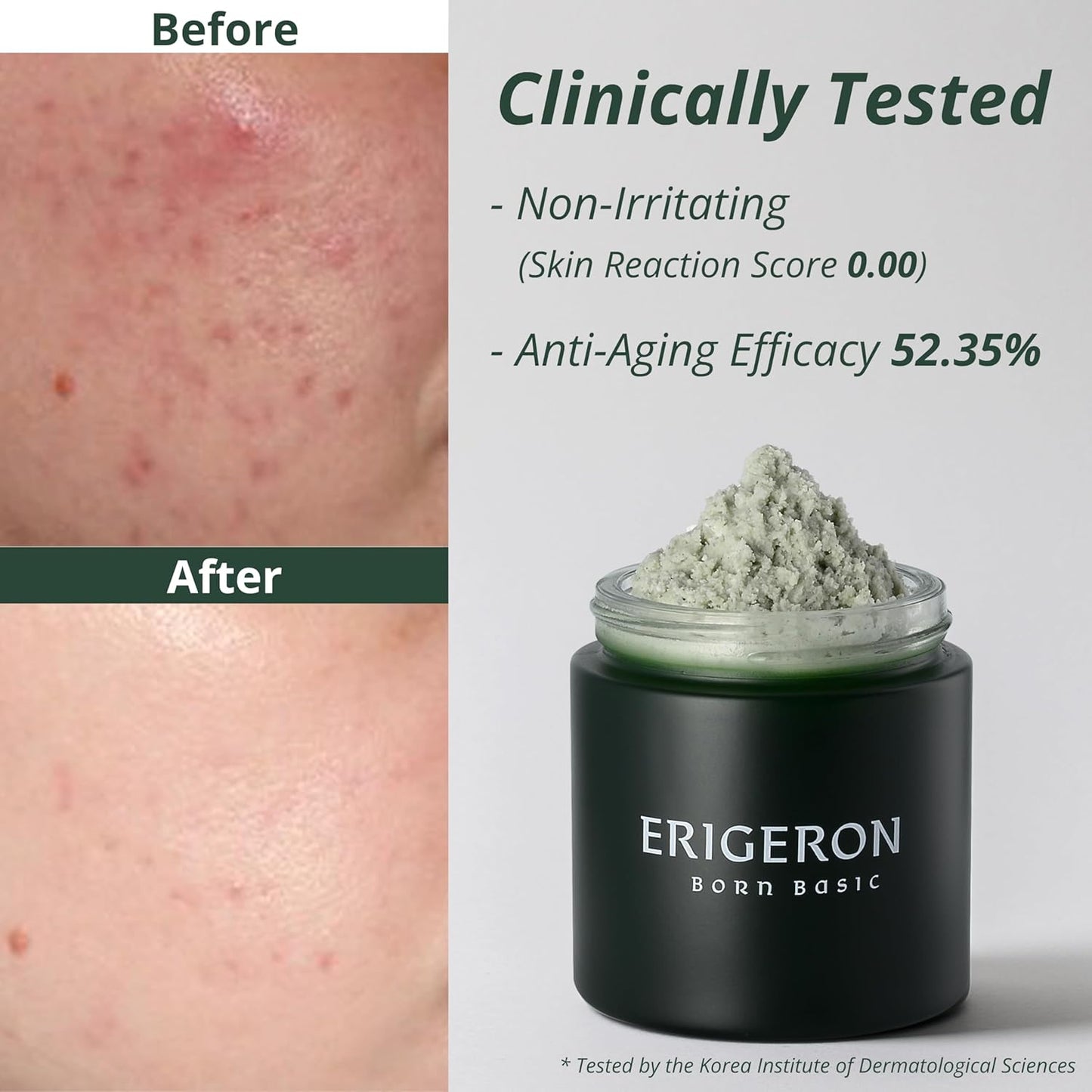 Heartleaf Facial Cleanser, Face Mask, Greek Yogurt Cleanser, Soothing, Deep Pore Scrubber & Face Wash with Green Tea, Blackhead Remover, Korean Skin Care (3.38 fl.oz.)