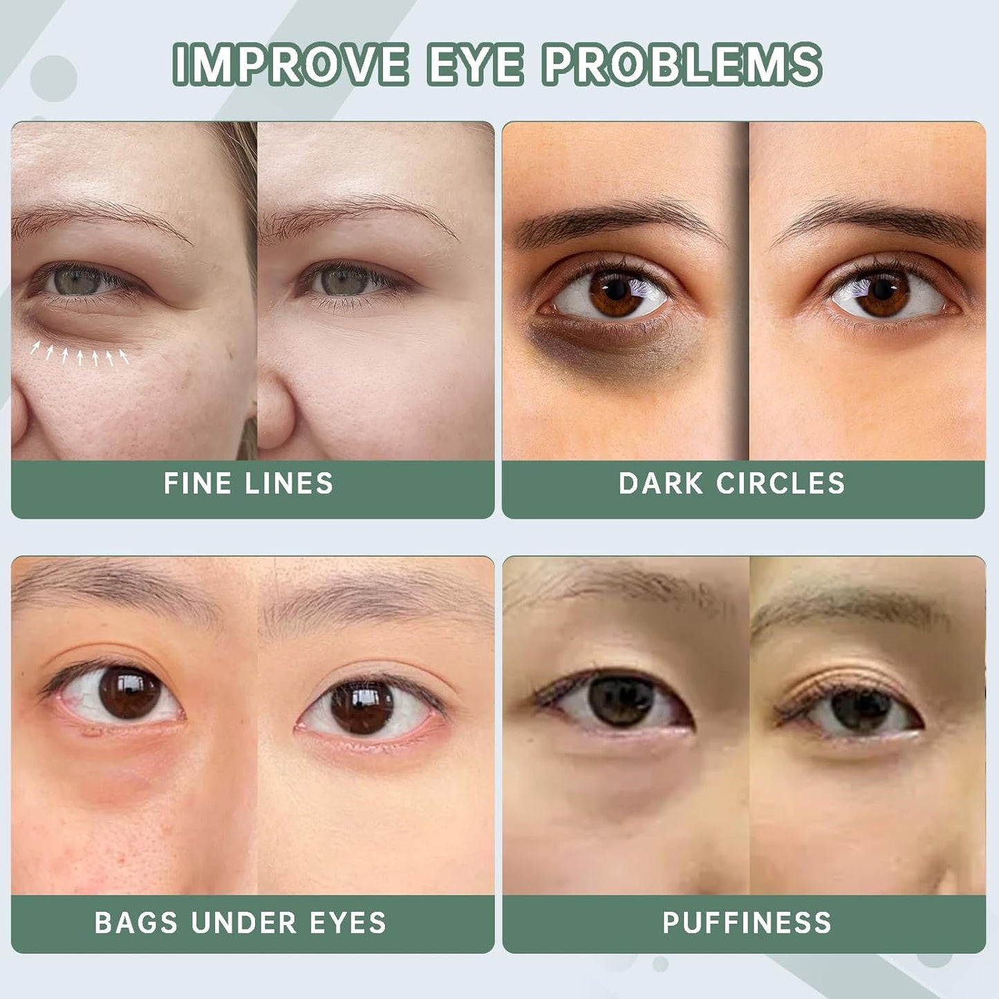 Caffeine Eye Serum for Reducing Puffiness and Dark Circles - 2Pcs Caffeine Solution 5%+EGCGE(30ml).