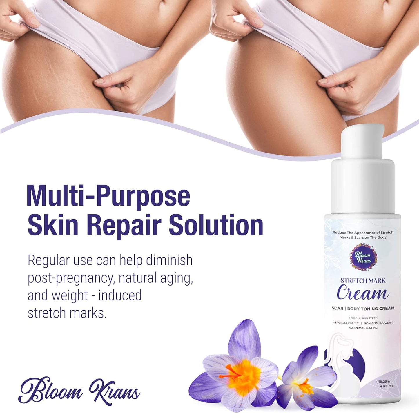 Bloom Krans Stretch Mark Cream for Pregnancy – Moisturizing Stretch Mark Remover Prevention Cream for the Pregnant Belly - Postpartum Lotion Essentials