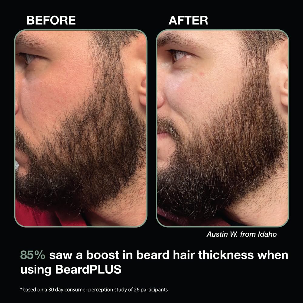 ZEUS BeardPLUS Conditioner for Men, Enhanced Beard Growth & Hair Care Treatment with Biotin & Caffeine to Boost Thickness, Strength, Hydration, and Skin Comfort (Made in USA) 6 oz.