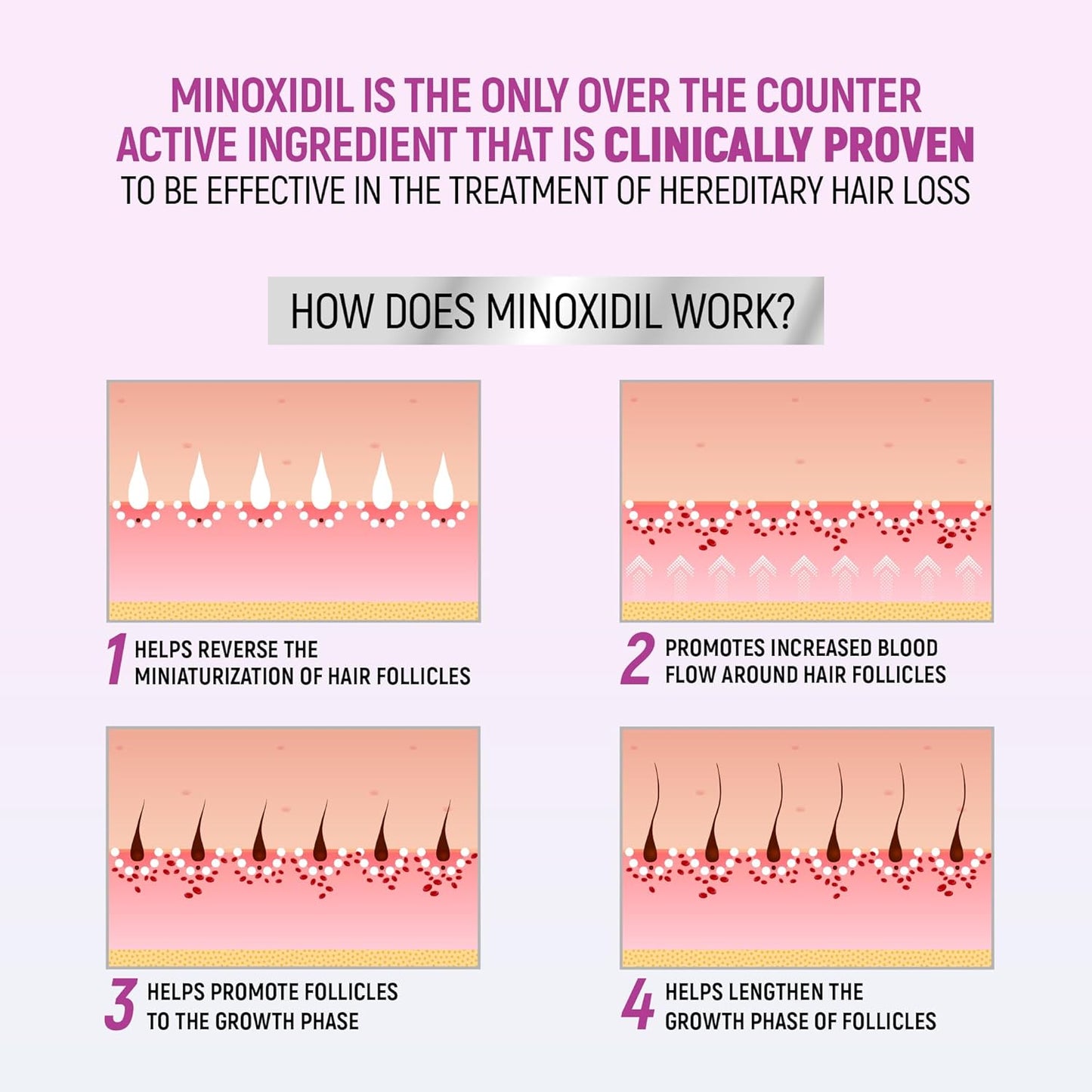 Taro Minoxidil for Women, 2.11 Oz (2 Months Supply) Clinically Proven to Regrow Hair, Topical Aerosol Foam 5%, Hair Thinning Treatment