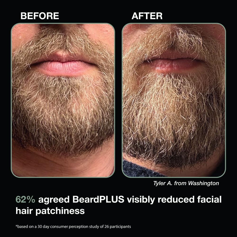 ZEUS BeardPLUS Conditioner for Men, Enhanced Beard Growth & Hair Care Treatment with Biotin & Caffeine to Boost Thickness, Strength, Hydration, and Skin Comfort (Made in USA) 6 oz.