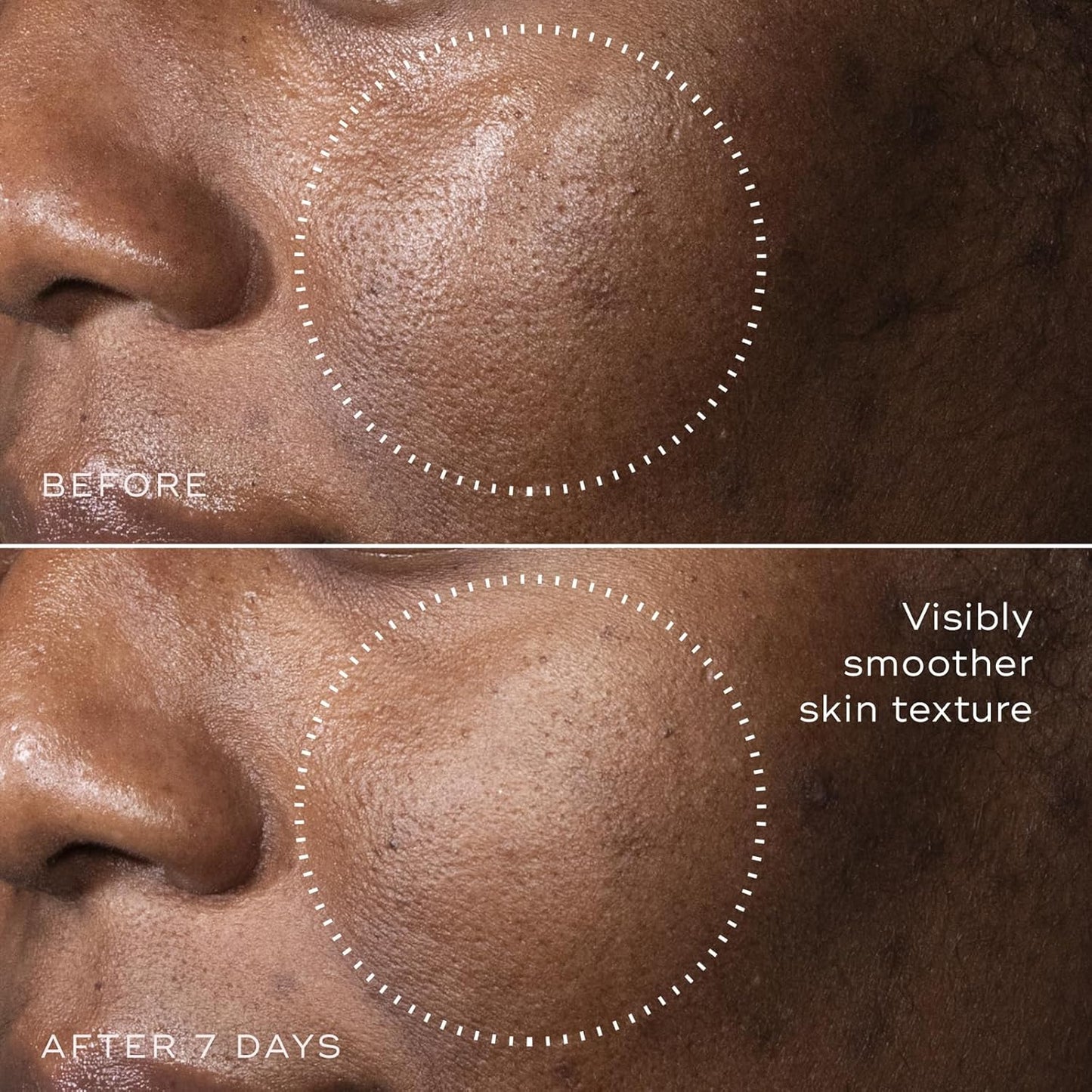 Medik8 C-Tetra Advanced - Balancing, Plumping, Hydrating Daily Vitamin C Serum with Hyaluronic Acid, Squalene - Smooths Fine Lines, Wrinkles - 1.0 oz