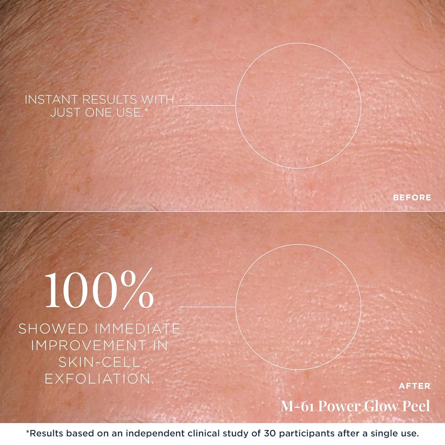 m-61 PowerGlow Peel | Exfoliating Facial Peel With Glycolic, Salicylic Acid. 1 Minute, 1 Step - 10 Treatments